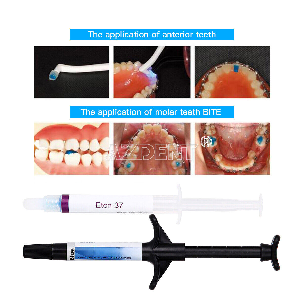 USA Dentex Dental Ortho Light Cure Adhesive Kit Blue Open Bite Band Bonding