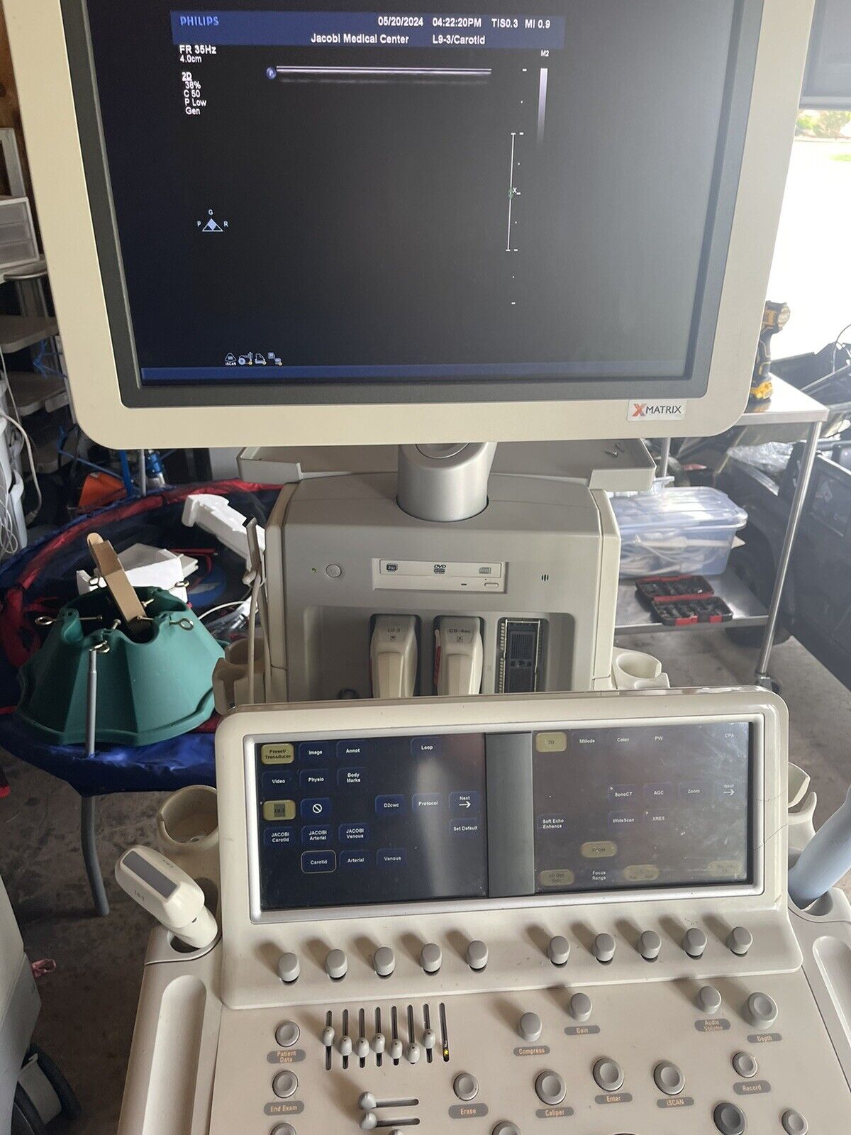 Philips iE33 xMatrix Ultrasound System With 2 Probe