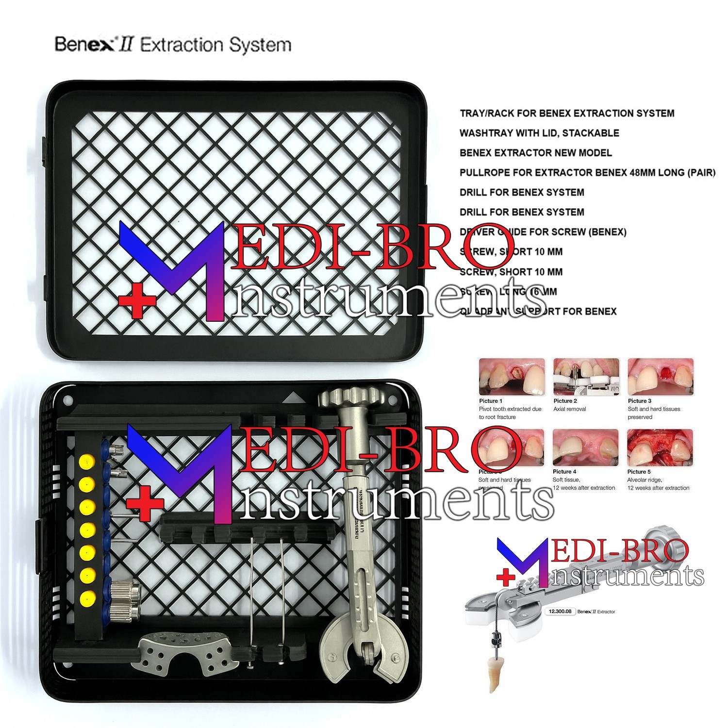 BENEX II Dental Extraction System – Complete Root Removal Kit BENEX II Dental Extraction System – Complete Root Removal Kit