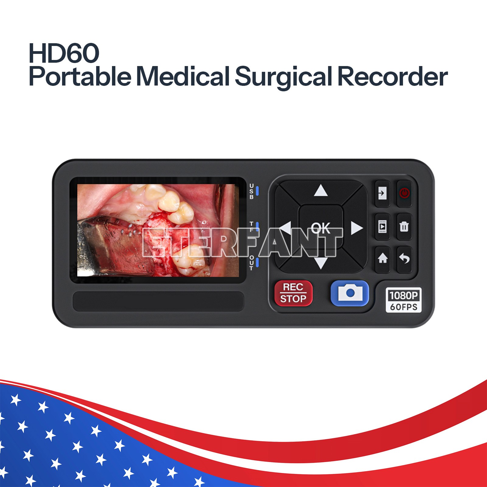 ETERFANT Dental Medical Surgical Recorder for Laparoscopy and Endoscopy Capture