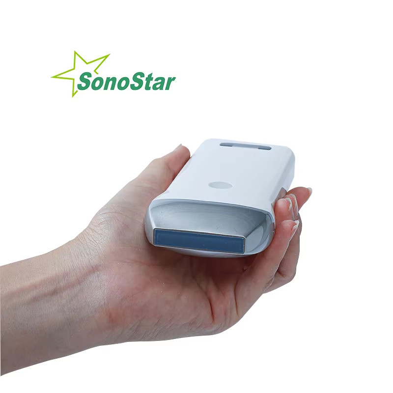 Wireless Ultrasound Probe Scanner Portable Machine Support iOS Android Windows Wireless Ultrasound Probe Scanner Portable Machine Support iOS Android Windows